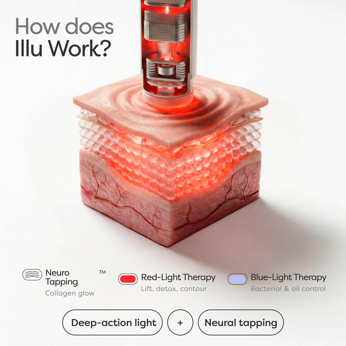 illu Neuro Tapping