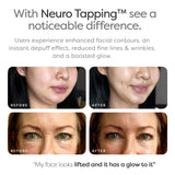 illu Neuro Tapping